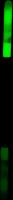 Zebco Splávek After Dark Snaplight Sensitive Float Kit (6)